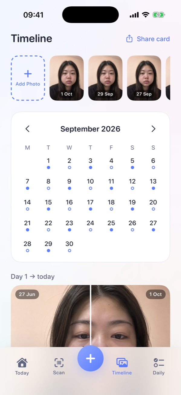 Tumlo's Timeline: daily photos and a calendar of logged days.